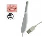 Digital Dental camera
