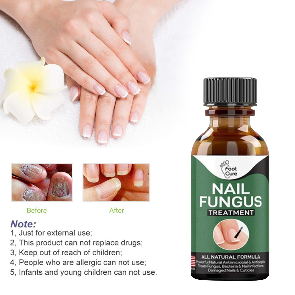 Wholesale Nail Repair Liquid Hand Foot leuconychia Care Repair Liquid