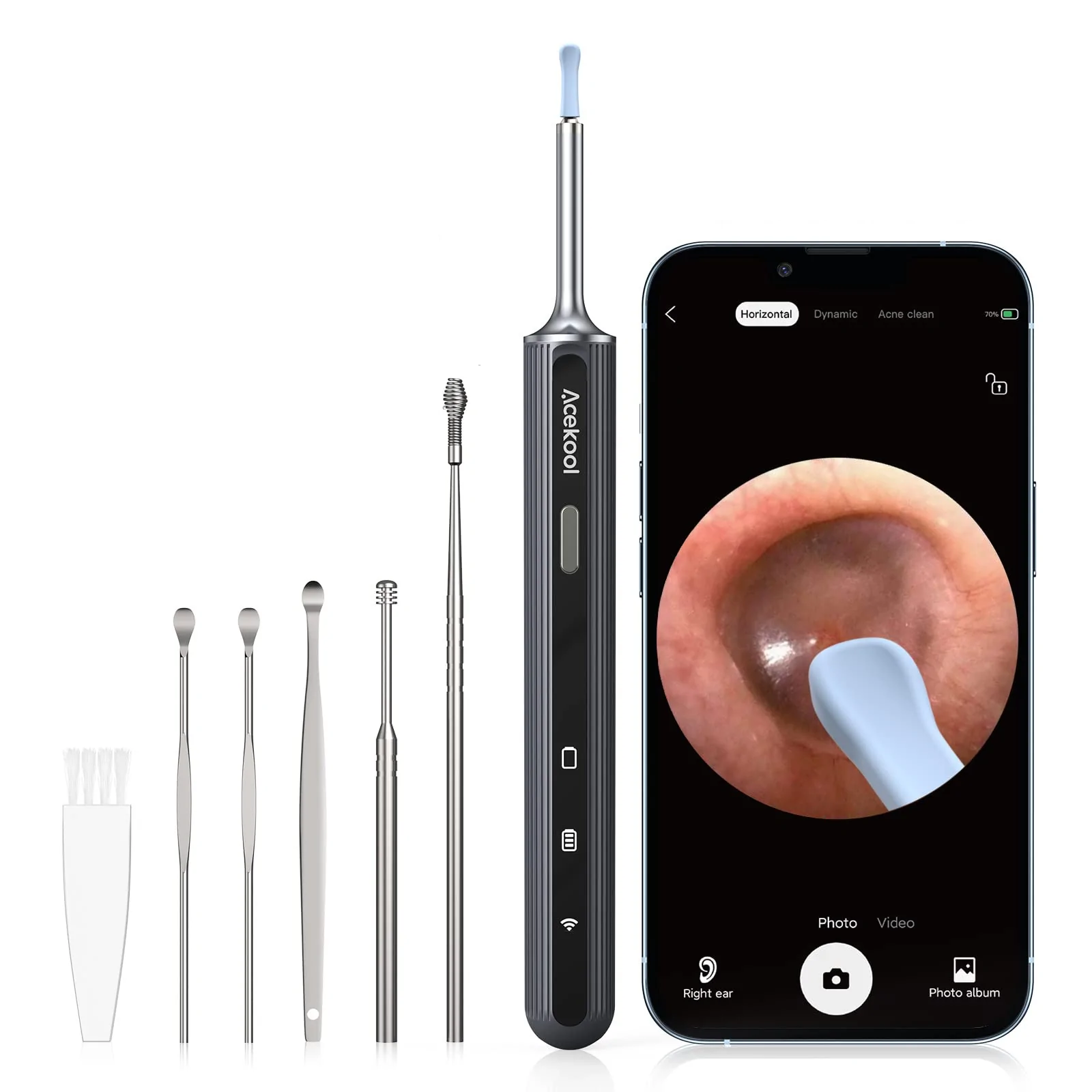 Ultimate ACEKOOL Ear Wax Removal EV1 with 1080P HD Ear Camera and Ear Cleaner from the USA