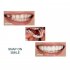 1 Pair Reusable Whitening Dentures Braces Dental Care Accessories 2PCS