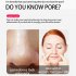 3 in 1 Pimple Remover Tool Portable Electric Face Cleanser Beauty Massager Skin Care For Pore Acne Blackhead Black Dot Pimple Remover