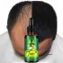 30ml Women Men Hair Care Growth Essence Liquid Fast Restoration Hair Hair Loss Nutrition Tool