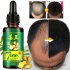 30ml Women Men Hair Care Growth Essence Liquid Fast Restoration Hair Hair Loss Nutrition Tool