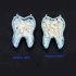 50Pcs Dental Teeth Veneers Whitening Crown Porcelain Dental Material Oral Care Posterior teeth