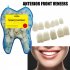 50pcs Multipurpose Dental Temporary Crown Front Teeth Replacement Kit For Makeup Scary Theme Party Makeup 50pcs
