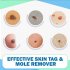 5ml Skin Tag Remover Pen Medical wart Remover Skin Tag Mole Genital Wart Removal Pen W section