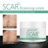 Acne Scar Removal Cream Repair Acne Spots Acne Treatment Whitening Shrink Pores Stretch Marks Skin Care Scar cream