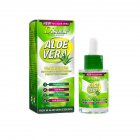 Aloe  Essence Moisturizing Brightening Soothing Skin Care Acne Moisturizing After sun Skin Repair 30ml