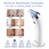 Blackhead Remover  USB Rechargeable Skin Cleaner with 4 Alternative Suction Heads  Comedo Extractor with 5 Adjustable Levels