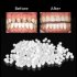 Dental Dentures Modified Temporary Teeth Homemade Dentures Missing Teeth Whitening Teeth CMaterials Denture Care Braces   filling gum