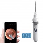 Ear Cleaner with Camera, APP Intelligent Visual Ear Wax Removal Tool with Light