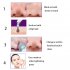 Electric Acne Remover Point Noir Blackhead Vacuum Extractor Tool Black Spots Pore Cleaner Skin Care   Rose Gold