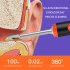 Electric Ear Wax Removal Tool Internal Lithium Battery 3mp Pixel Camera Silicone Ear Tip Wifi Connection White