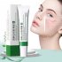 Facial Cream Whitening Moisturizing Shrinking Face Acne Removal Cream Acne Relief Cream 20g