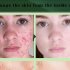 Facial Cream Whitening Moisturizing Shrinking Face Acne Removal Cream Whitening Cream 20g
