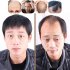 Human Wig Hair Topper Toupee Clip Hairpiece Lace Top Wig for Men Natural black 16x18