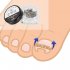 Nail Art Ingrowing nail Correction Wire Recover Care Paronychia File Patch Corrector Foot Pedicure Tool 4 piece set