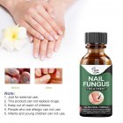 Nail Repair Liquid Hand Foot  leuconychia Care Repair Liquid Antibacterial And Thickening Soft Nail 50ml