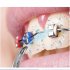 Portable Dental Flosser Teeth Pick  4 Nozzles Oral Irrigator Waterproof Electric Waterflosser Flossing Machine With 3 Modes 0 5 MM Slim Water Teeth Pick For Ort