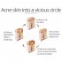Shrink Pores Serum Pore Tightens Refining Moisturizing Essence Facial Essence Skin Care 30ml