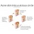 Shrink Pores Serum Pore Tightens Refining Moisturizing Essence Facial Essence Skin Care 30ml