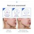 Shrink Pores Serum Pore Tightens Refining Moisturizing Essence Facial Essence Skin Care 30ml