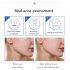 Shrink Pores Serum Pore Tightens Refining Moisturizing Essence Facial Essence Skin Care 30ml