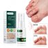 Skin  Care  Spay Plant Extract Help Remove Fungus For Dry Chapped Peeling Skin Care 20ml