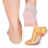 Skin Softening Medical Grade Silicone Gel Heel Sleeves for Dry Cracked Heel with Protective Cushioning and Plantar