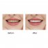 Ultrasonic Toothbrush  LED Light Waterproof U Shaped Brush Head Protects Gums  360   Oral Cleaning Ordinary White