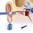 Ear Cleaning Scoop